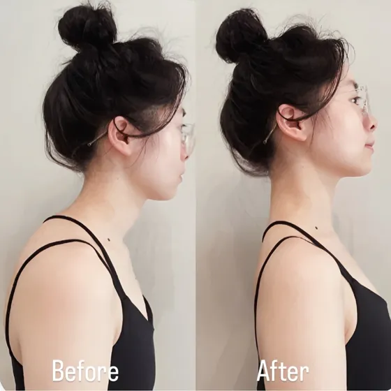 Pelvic Harmony & Posture Refinement Therapy