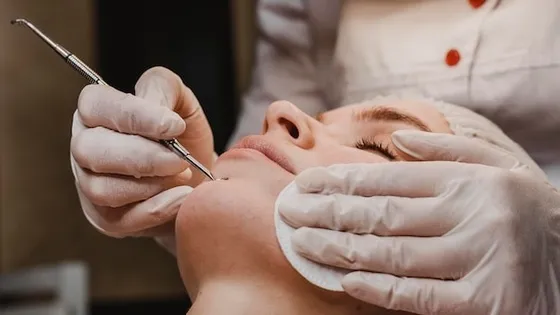 Acne Treatment Facial
